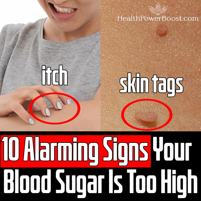 10 Alarming Signs Your Blood Sugar Is Too High