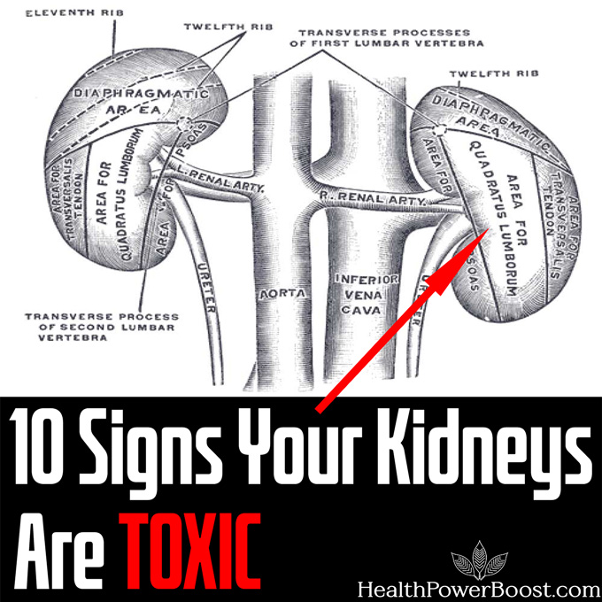 10 Signs Your Kidneys Are Toxic