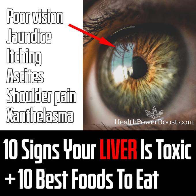 10 Warning Signs That Your Liver Is Toxic