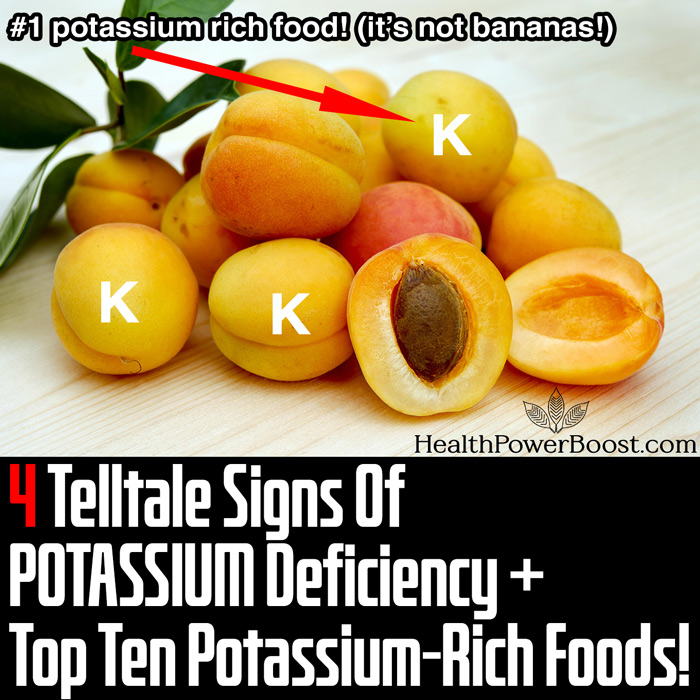 4 Telltale Signs Of POTASSIUM Deficiency Plus The Top 10 Potassium-Rich Foods