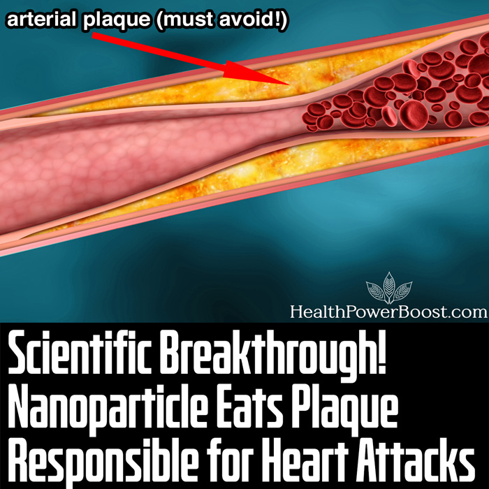 Scientific Breakthrough - Nanoparticle Eats Plaque Responsible for Heart Attacks