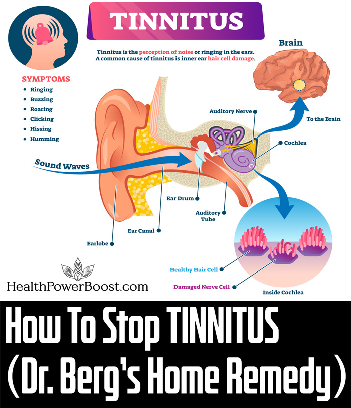 How To Stop Tinnitus